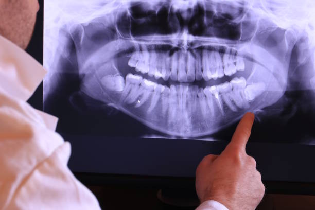 Best Walk-In Emergency Dental Services in New Braunfels, TX