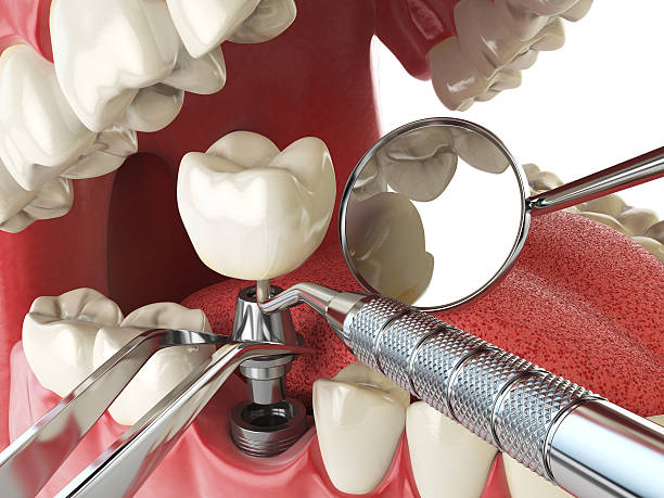 Best Urgent Dental Care for Toothaches in New Braunfels, TX
